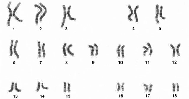 Thuốc lá làm tiêu hủy nhiễm sắc thể Y ở đàn ông