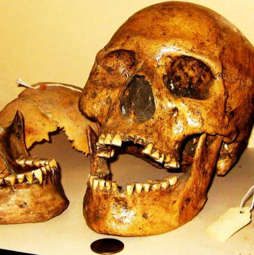 Đầu lâu người khổng lồ bên cạnh đầu lâu người thường ở Nhà bảo tàng Humboldt. Đầu lâu người khổng lồ bên cạnh đầu lâu người thường ở Nhà bảo tàng Humboldt.