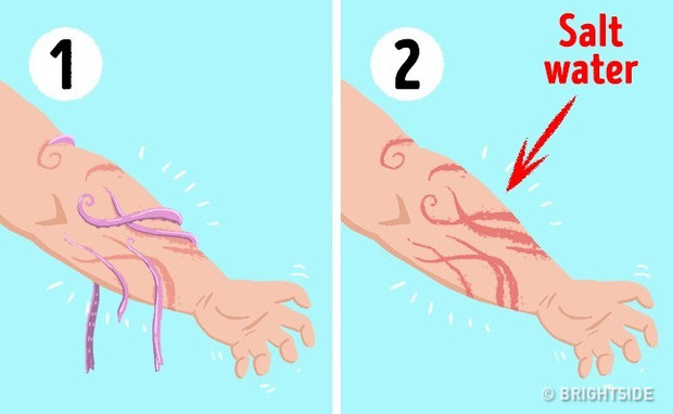 Rửa sạch vết thương bằng nước muối.
