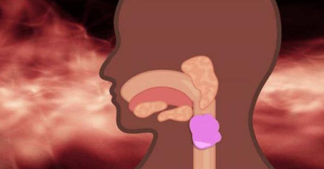 Điều gì xảy ra khi bạn nuốt kẹo cao su