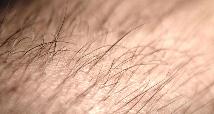 Lông tóc vẫn mọc sau khi chết?